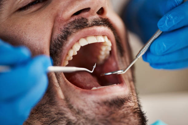 Best Knocked-Out Tooth Emergency  in Jekyll Island, GA